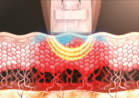 dentisy-camadas-02